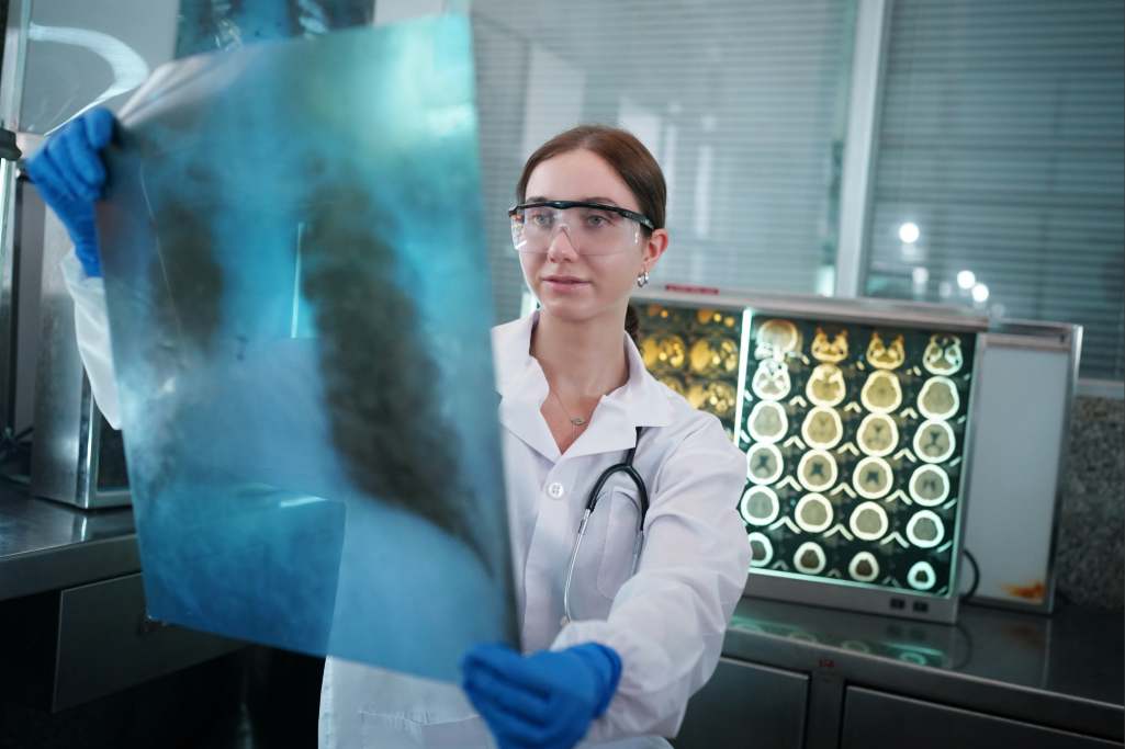 Plano de saúde deve custear remédio de alto custo para fibrose pulmonar